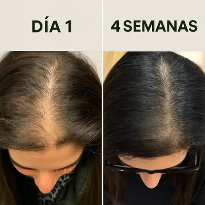 Batana Luxe – Crecimiento y Reparación Capilar