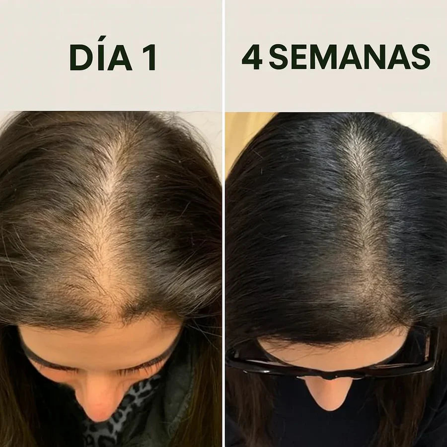 Shampo de Batana oil - Crecimiento y Reparación Capilar